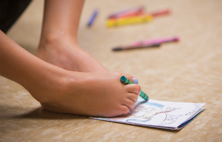 Gillette Children's patient Ruth Evelyn, born without arms uses her feet to color a picture