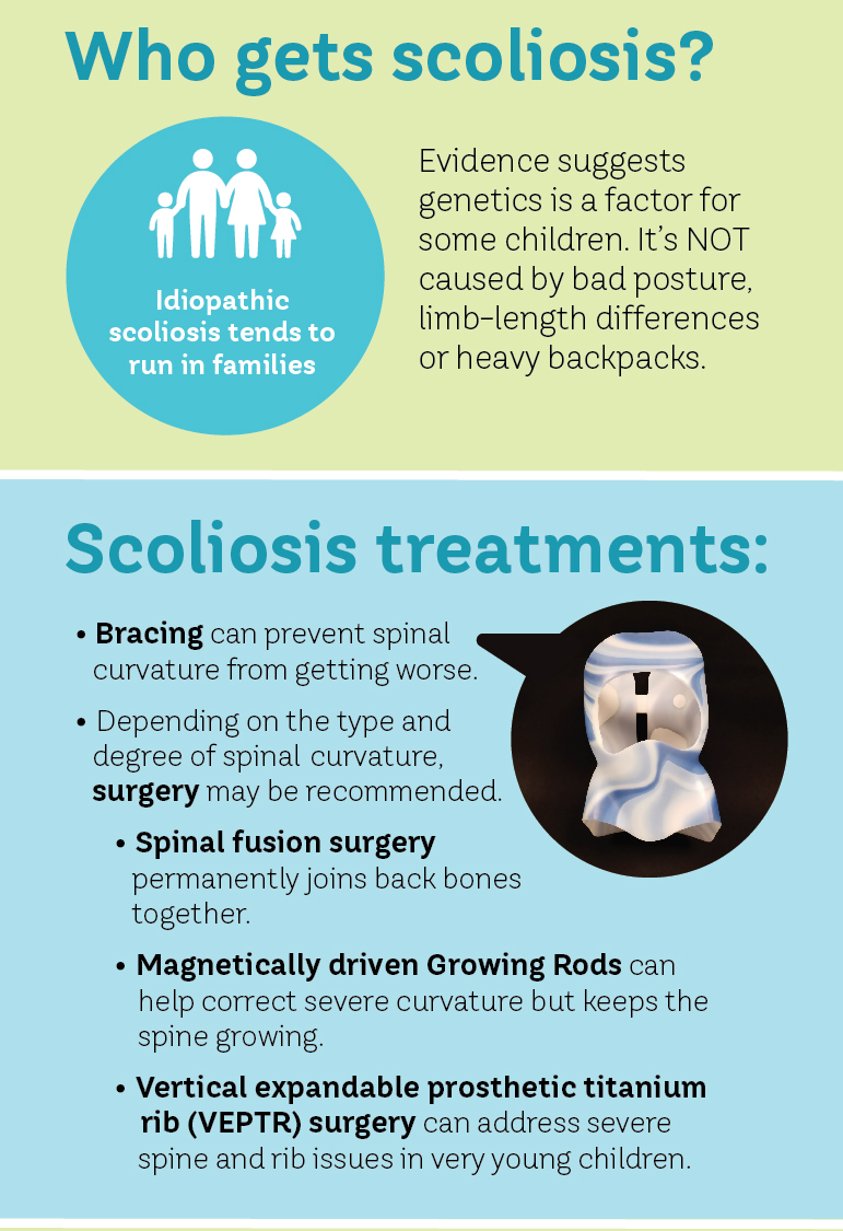 Scoliosis Infographic
