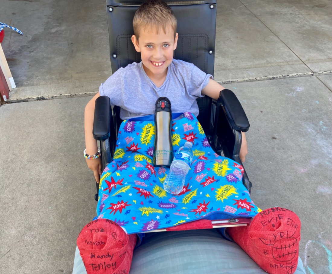Bennett in a wheelchair with two casts