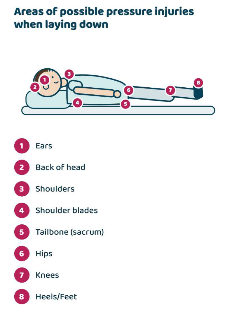 Areas of possible pressure injuries when laying down