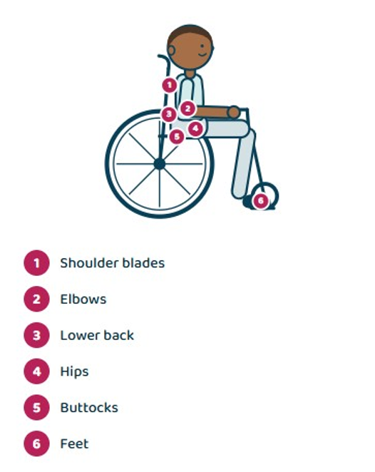 Common areas of possible pressure injuries while in a wheelchair - Gillette Children's