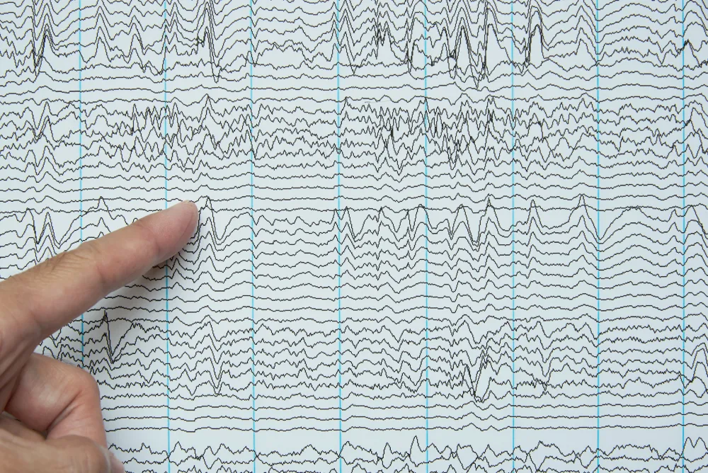 EEG printout example.