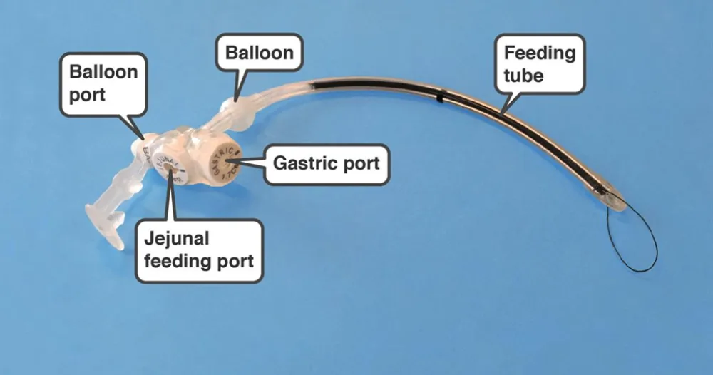 Photo of Gastrojejunostomy conversion components.