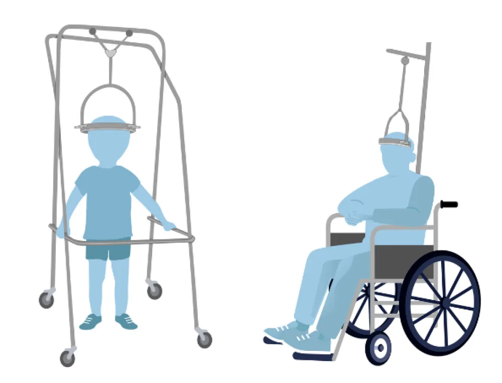 Illustration of patients with halo traction.