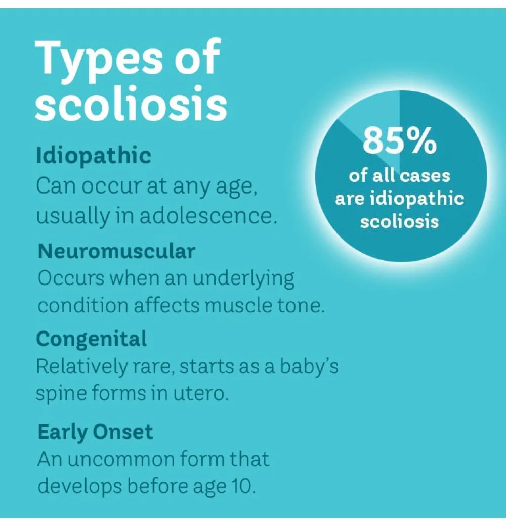 A Gillette Children's graphic defining idiopathic, neuromuscular, congenital, and early onset scoliosis. The graphic indicates that 85% of all scoliosis cases are idiopathic.