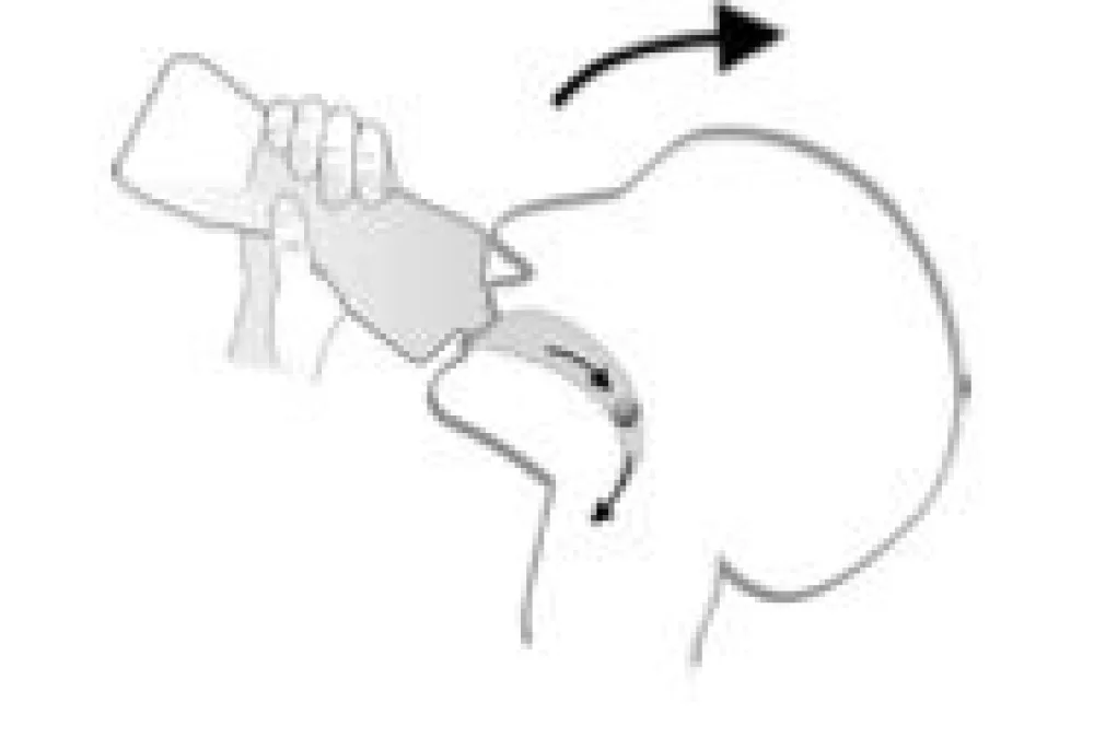 An image of the Water Bottle Method to swallow medication at Gillette Children's