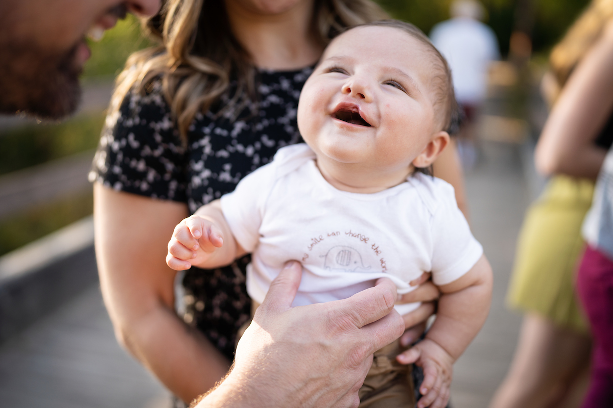 A Cleft Lip and Palate Gillette Children's patient with his family at park