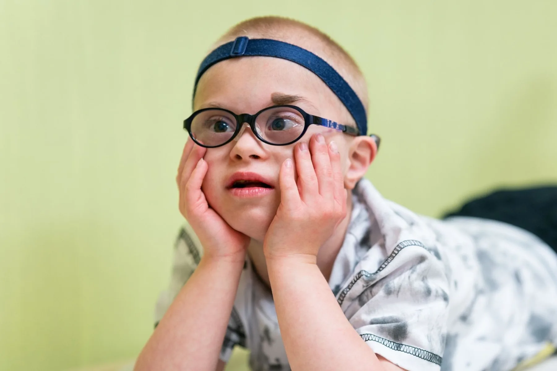 Child with down syndrome laying on stomach -  - Gillette Children's.
