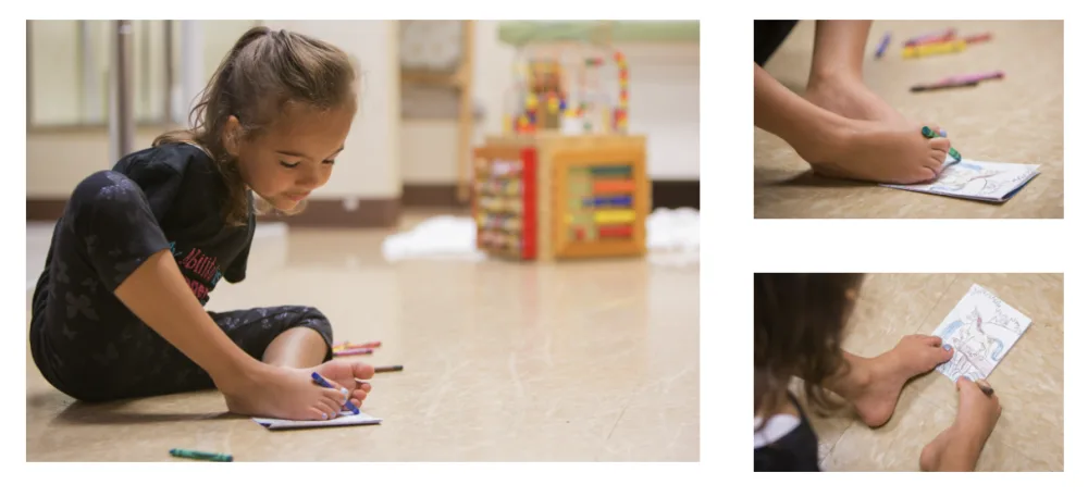Ruth Evelyn draws a picture at Gillette Children's.