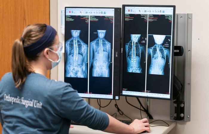 PA-C Danielle Harding reviews a patient's spine x-rays at Gillette Children's.
