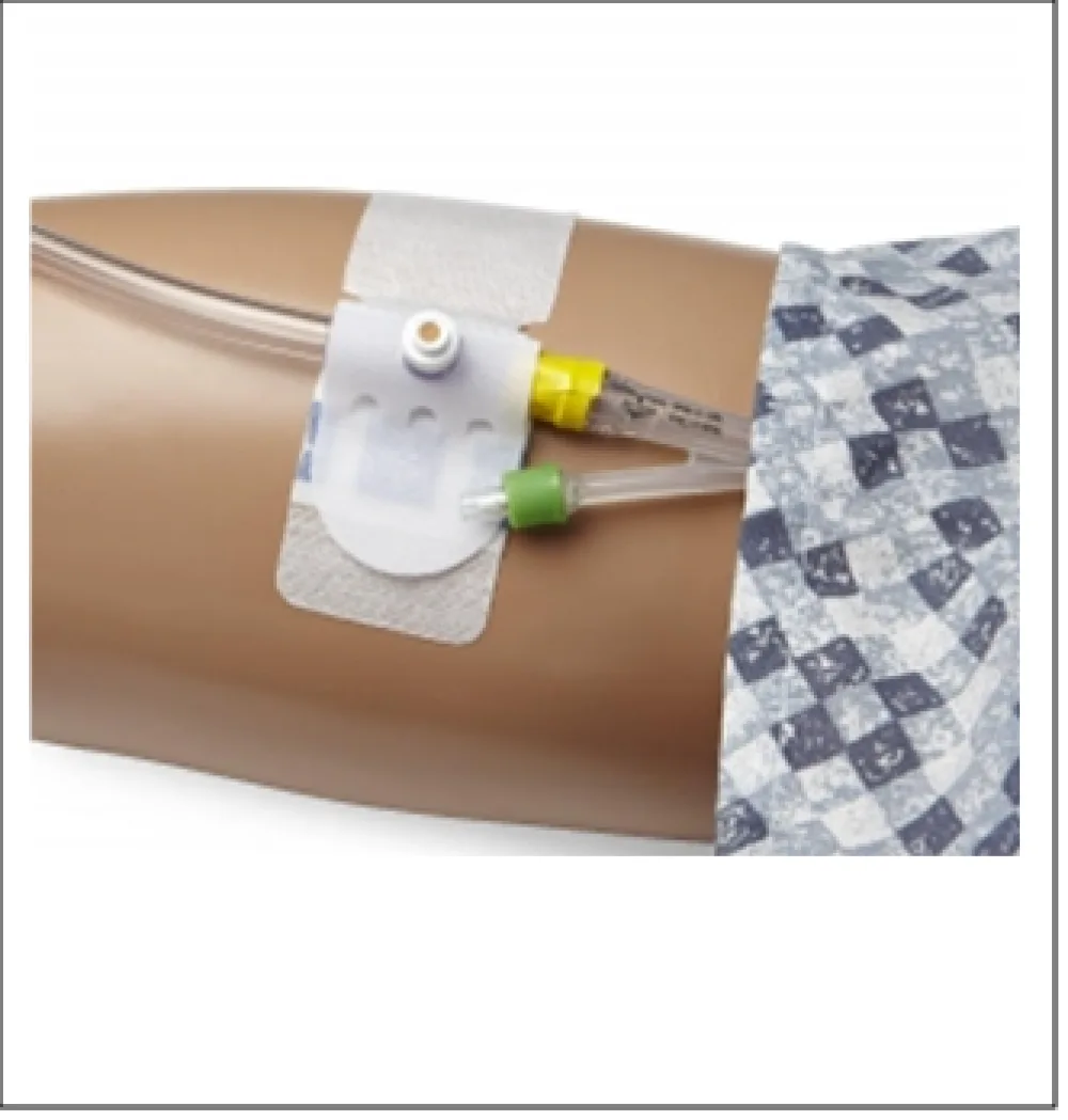 An image of a Foley catheter port at Gillette Children's