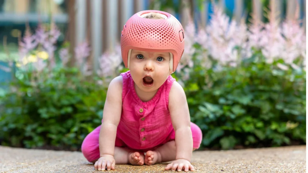 Baby wearing Talee helmet.