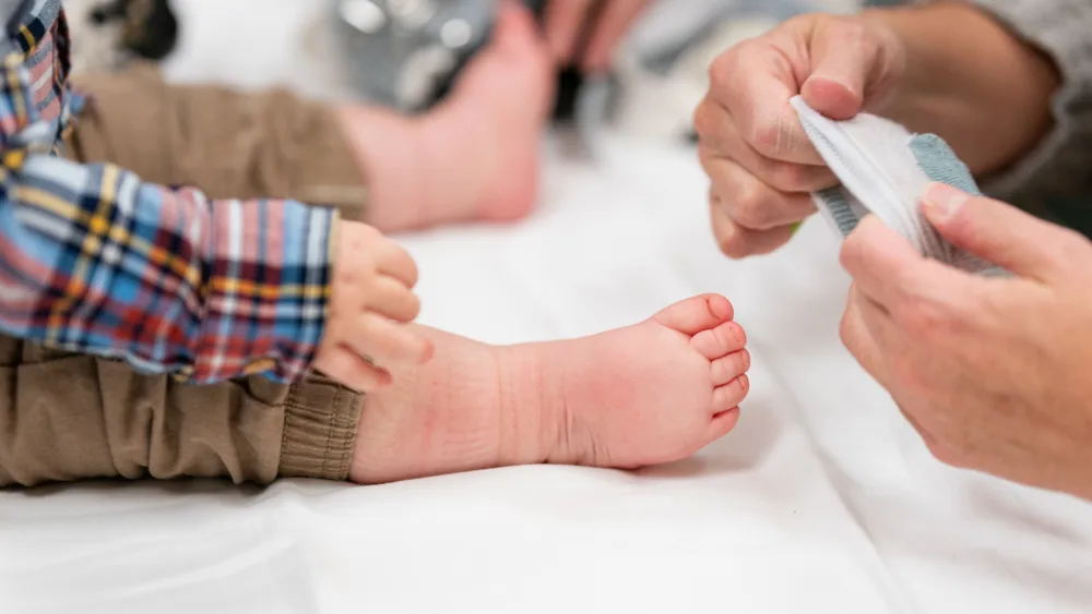 A closeup of Wyatt Krentz's right foot as he is examined in the Clubfoot Clinic.