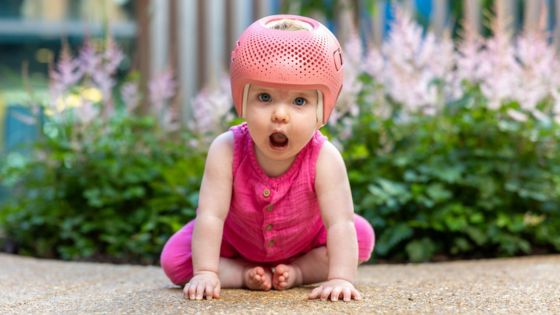 Child wearing talee helmet